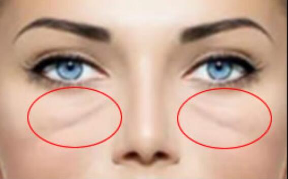 撕掉歲月痕跡！提拉緊致美容儀助你閃耀