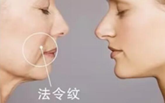 改善法令紋美容儀：科技創(chuàng)新，讓你告別歲月痕跡！