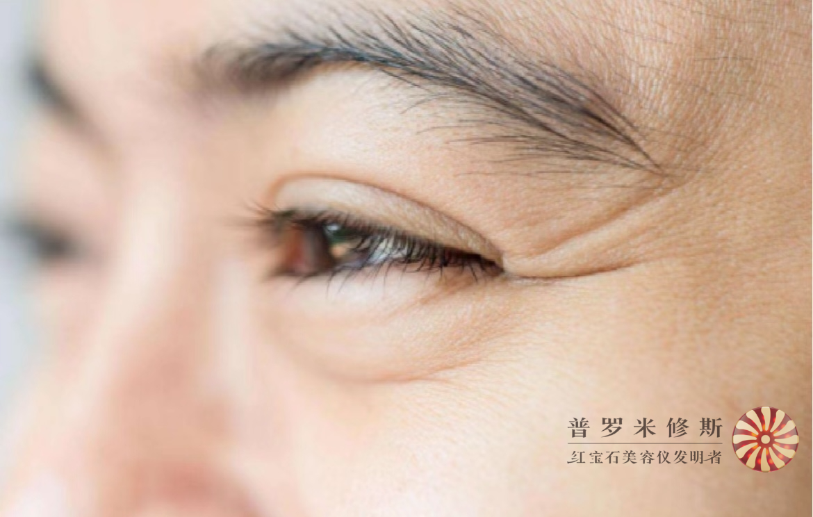 烙鐵們，你的魚尾紋真的需要熨一下！