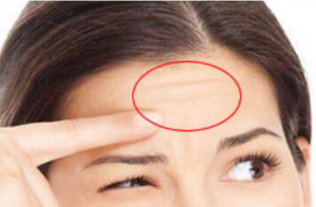 一分鐘學(xué)會(huì)如何告別抬頭紋