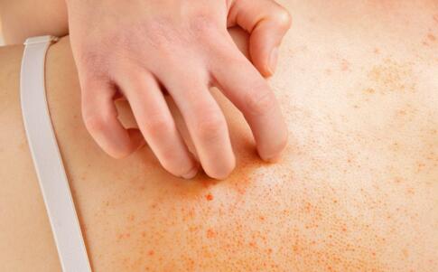 護(hù)膚私語：秋冬激光祛斑不易反彈