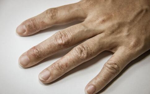 曝光韓國最美女星祛斑秘籍[3]