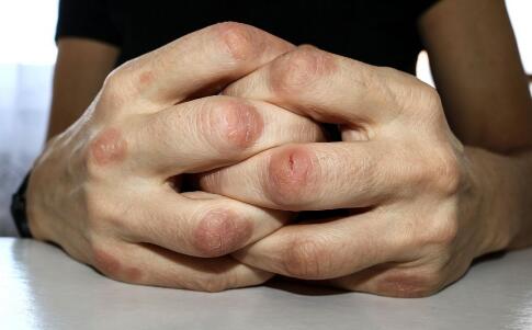 曝光韓國最美女星祛斑秘籍[5]