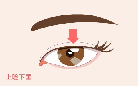 激光祛斑 神奇斑點“橡皮擦”