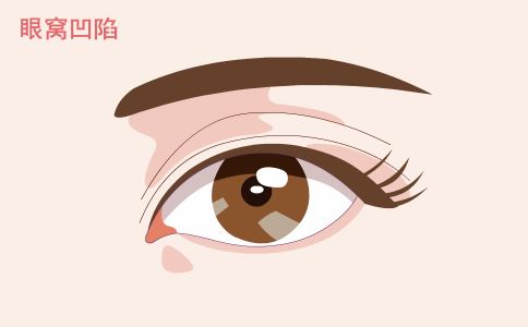 打造無痕肌膚，選擇激光祛痘印就是關(guān)鍵！