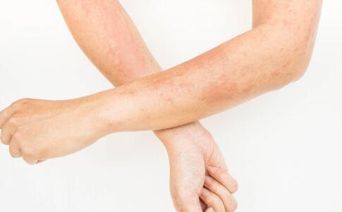 曝光韓國(guó)最美女星祛斑秘籍