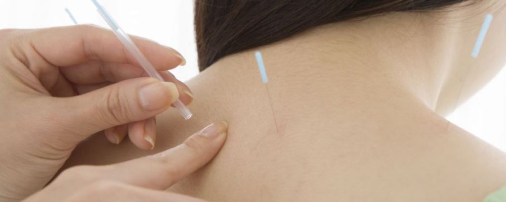 針灸美容 以內(nèi)調(diào)外效果好