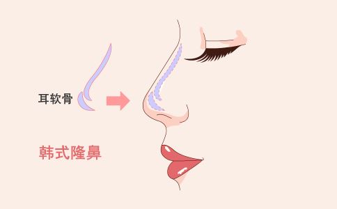 光子嫩膚祛斑的效果