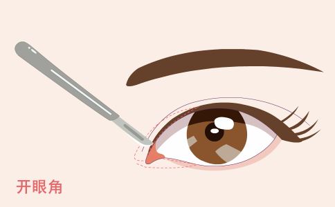 炎炎夏日，激光祛斑助你煥發(fā)美麗光彩，成為焦點女神！