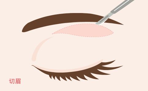 美麗背后隱藏的風險！激光祛斑對皮膚真的安全嗎？