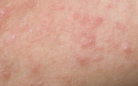 白醋神奇美膚術(shù)！一招教你用白醋洗臉，美白祛斑不再是夢！