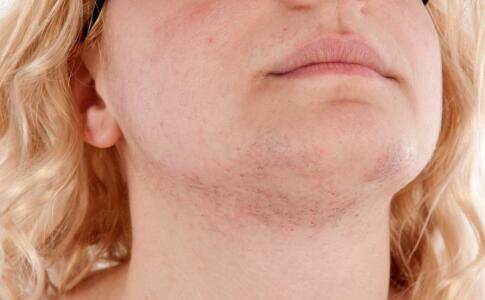 維C神奇美白法：祛斑小竅門，讓你肌膚煥發(fā)雪白光澤！