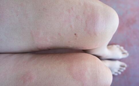 一夜之間變身白雪公主：朋友圈熱傳的美白秘籍，你敢嘗試嗎？