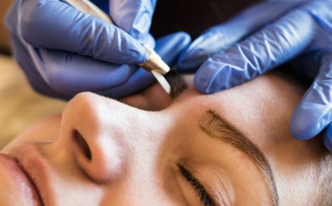 光子祛斑有哪些壞處 術(shù)后護(hù)理須小心