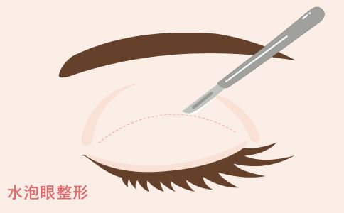 激光祛斑：了解原理，遵循術前術后要求，美麗肌膚輕松得！