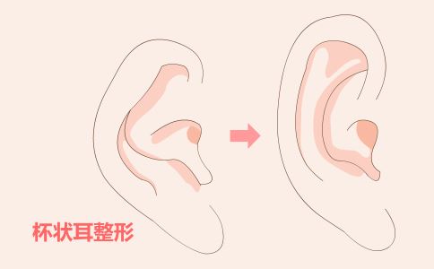 黑臉娃娃是什么 美白肌膚又淡斑