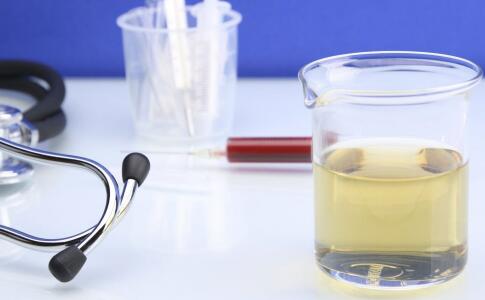 黃褐斑需檢查病因 女性如何預(yù)防黃褐斑