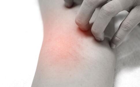 可以治療色斑的偏方