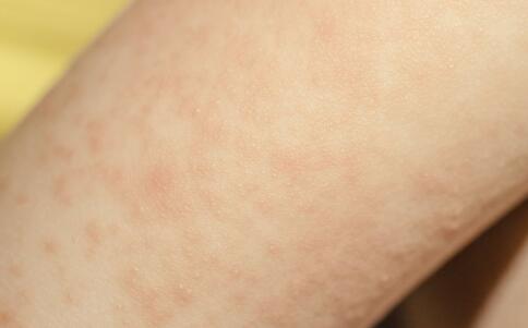 哪些蔬菜可以淡化色斑