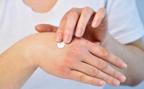 為什么臉上會(huì)形成煩人色斑