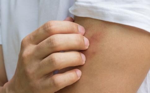 芳香精油理療法祛痘