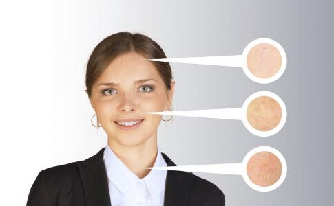 藥監(jiān)局：祛痘異維A酸致畸形 兩年內(nèi)不能要小孩