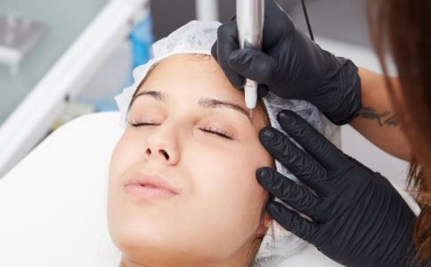 中醫(yī)祛痘的小方法