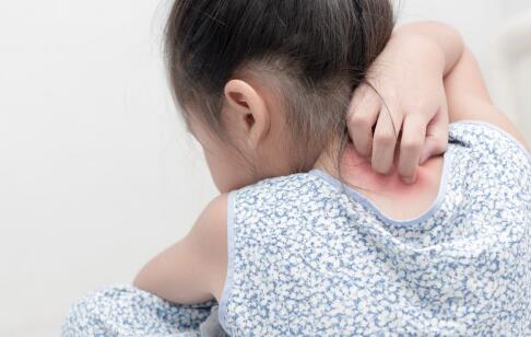 祛痘太難了？強烈安利ORDET痘肌涼茶，對痘印痘坑都有效！