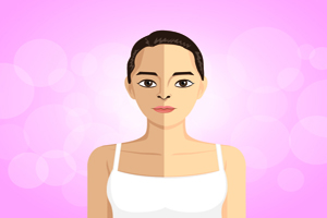 維生素e祛斑有效嗎