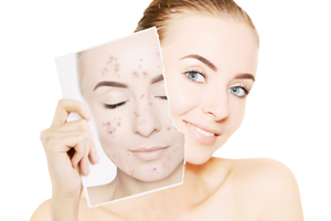 韓國(guó)馬油面膜好用嗎