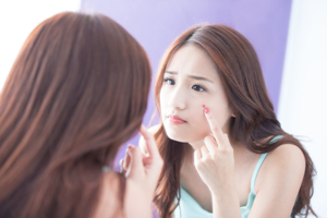 白糖怎樣去痘印