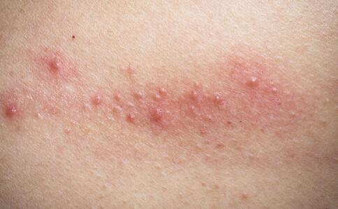 10大原因讓女人老得快