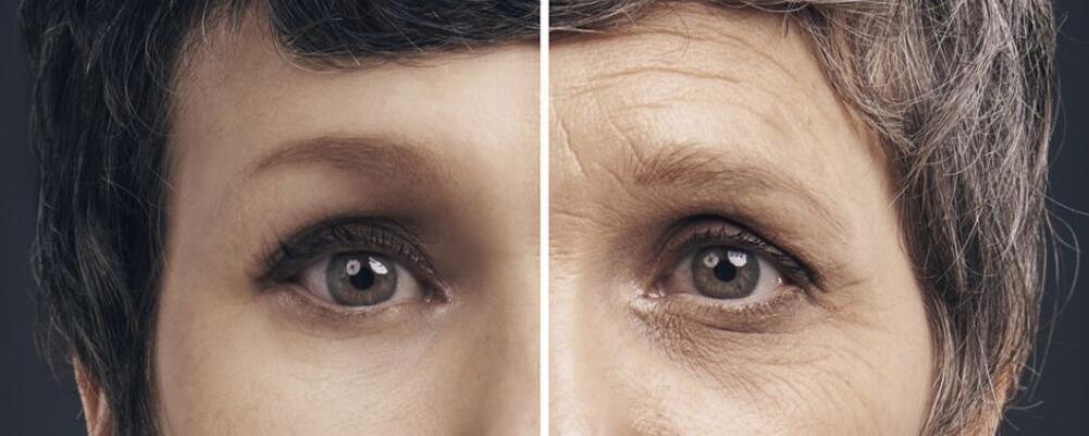 消除頸部皺紋的7個方法