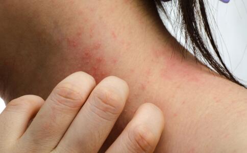 82歲老太要求整容除皺紋 經(jīng)常坐飛機(jī)旅行