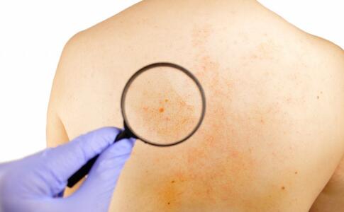 女性怎么按摩祛除皺紋