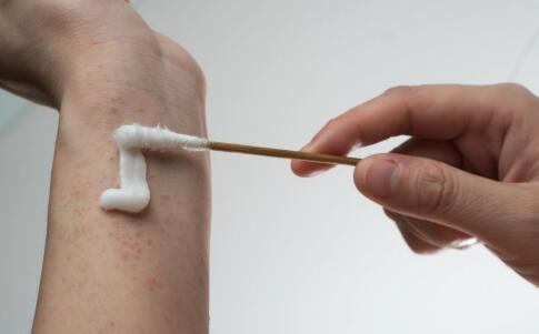 怎么用電波拉皮解決皺紋問題