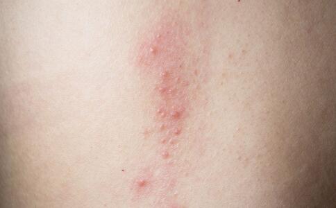 輕松去除影響女人美麗的皺紋