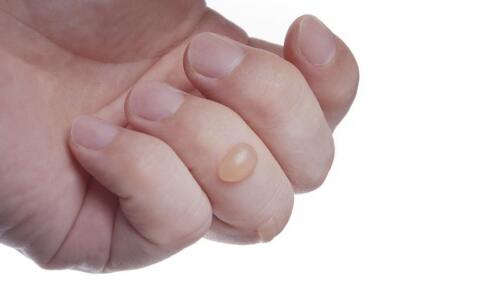 拉皮除皺要做的手術(shù)前準(zhǔn)備