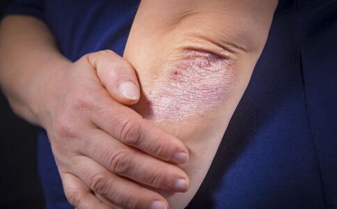 皮膚暗黃怎樣可以變白