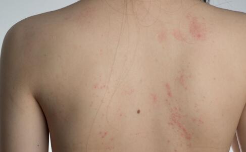 專家教你秋冬如何護理皮膚