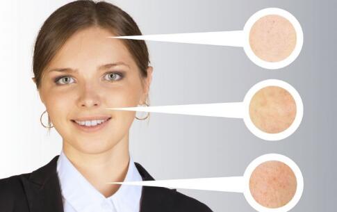 不同年齡的冬季眼角抗衰方案